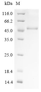 Recombinant Human Sorting neXIn-16 (SNX16) - image 1