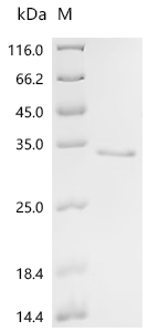 Recombinant Pig Superoxide dismutase [Cu-Zn] (SOD1) - image 1