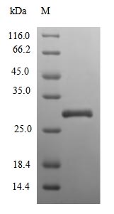 (Tris-Glycine gel) Discontinuous SDS-PAGE (reduced) with 5% enrichment gel and 15% separation gel. (Tris-Glycine gel) Discontinuous SDS-PAGE (reduced) with 5% enrichment gel and 15% separation gel.
