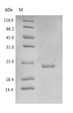 (Tris-Glycine gel) Discontinuous SDS-PAGE (reduced) with 5% enrichment gel and 15% separation gel. (Tris-Glycine gel) Discontinuous SDS-PAGE (reduced) with 5% enrichment gel and 15% separation gel.