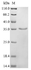 Recombinant Human Sorbin and SH3 domain-containing protein 2 (SORBS2) , partial - image 1