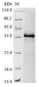 (Tris-Glycine gel) Discontinuous SDS-PAGE (reduced) with 5% enrichment gel and 15% separation gel. (Tris-Glycine gel) Discontinuous SDS-PAGE (reduced) with 5% enrichment gel and 15% separation gel.
