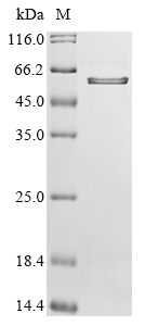 (Tris-Glycine gel) Discontinuous SDS-PAGE (reduced) with 5% enrichment gel and 15% separation gel. (Tris-Glycine gel) Discontinuous SDS-PAGE (reduced) with 5% enrichment gel and 15% separation gel.