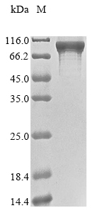 (Tris-Glycine gel) Discontinuous SDS-PAGE (reduced) with 5% enrichment gel and 15% separation gel. (Tris-Glycine gel) Discontinuous SDS-PAGE (reduced) with 5% enrichment gel and 15% separation gel.