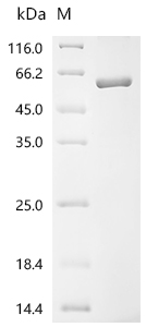 Recombinant Human Sushi repeat-containing protein SRPX2 (SRPX2) - image 1