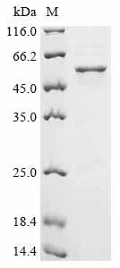 Recombinant Human Lupus La protein (SSB) - image 1