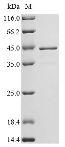 (Tris-Glycine gel) Discontinuous SDS-PAGE (reduced) with 5% enrichment gel and 15% separation gel. (Tris-Glycine gel) Discontinuous SDS-PAGE (reduced) with 5% enrichment gel and 15% separation gel.