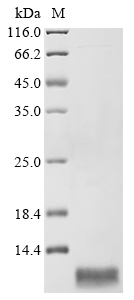 (Tris-Glycine gel) Discontinuous SDS-PAGE (reduced) with 5% enrichment gel and 15% separation gel. (Tris-Glycine gel) Discontinuous SDS-PAGE (reduced) with 5% enrichment gel and 15% separation gel.
