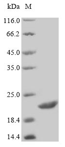 (Tris-Glycine gel) Discontinuous SDS-PAGE (reduced) with 5% enrichment gel and 15% separation gel. (Tris-Glycine gel) Discontinuous SDS-PAGE (reduced) with 5% enrichment gel and 15% separation gel.