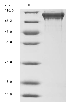 (Tris-Glycine gel) Discontinuous SDS-PAGE (reduced) with 5% enrichment gel and 15% separation gel. (Tris-Glycine gel) Discontinuous SDS-PAGE (reduced) with 5% enrichment gel and 15% separation gel.