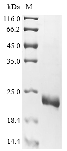 (Tris-Glycine gel) Discontinuous SDS-PAGE (reduced) with 5% enrichment gel and 15% separation gel. (Tris-Glycine gel) Discontinuous SDS-PAGE (reduced) with 5% enrichment gel and 15% separation gel.