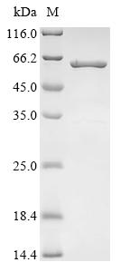 (Tris-Glycine gel) Discontinuous SDS-PAGE (reduced) with 5% enrichment gel and 15% separation gel. (Tris-Glycine gel) Discontinuous SDS-PAGE (reduced) with 5% enrichment gel and 15% separation gel.
