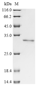 Recombinant Human Elongin-A3 member D (ELOA3DP) , partial - image 1