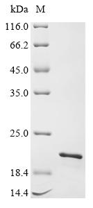 (Tris-Glycine gel) Discontinuous SDS-PAGE (reduced) with 5% enrichment gel and 15% separation gel. (Tris-Glycine gel) Discontinuous SDS-PAGE (reduced) with 5% enrichment gel and 15% separation gel.