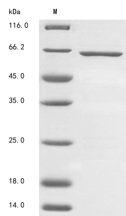 (Tris-Glycine gel) Discontinuous SDS-PAGE (reduced) with 5% enrichment gel and 15% separation gel. (Tris-Glycine gel) Discontinuous SDS-PAGE (reduced) with 5% enrichment gel and 15% separation gel.