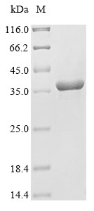 (Tris-Glycine gel) Discontinuous SDS-PAGE (reduced) with 5% enrichment gel and 15% separation gel. (Tris-Glycine gel) Discontinuous SDS-PAGE (reduced) with 5% enrichment gel and 15% separation gel.