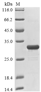 (Tris-Glycine gel) Discontinuous SDS-PAGE (reduced) with 5% enrichment gel and 15% separation gel. (Tris-Glycine gel) Discontinuous SDS-PAGE (reduced) with 5% enrichment gel and 15% separation gel.