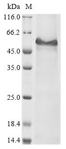Recombinant Human Thyroglobulin (TG) , partial - image 1