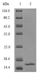 (Tris-Glycine gel) Discontinuous SDS-PAGE (reduced) with 5% enrichment gel and 15% separation gel. (Tris-Glycine gel) Discontinuous SDS-PAGE (reduced) with 5% enrichment gel and 15% separation gel.