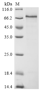 Recombinant Human Thrombomodulin (THBD) , partial - image 1
