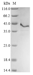 Recombinant Human Thrombomodulin (THBD) , partial - image 1