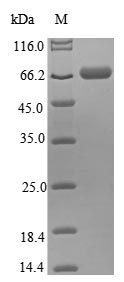 (Tris-Glycine gel) Discontinuous SDS-PAGE (reduced) with 5% enrichment gel and 15% separation gel. (Tris-Glycine gel) Discontinuous SDS-PAGE (reduced) with 5% enrichment gel and 15% separation gel.