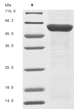 Recombinant Human Thyroid hormone receptor alpha (THRA) - image 1