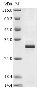 Recombinant Mouse Metalloproteinase inhibitor 3 (Timp3) - image 1