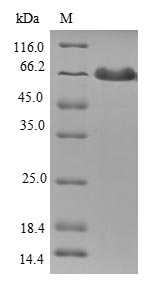 (Tris-Glycine gel) Discontinuous SDS-PAGE (reduced) with 5% enrichment gel and 15% separation gel. (Tris-Glycine gel) Discontinuous SDS-PAGE (reduced) with 5% enrichment gel and 15% separation gel.