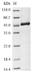 (Tris-Glycine gel) Discontinuous SDS-PAGE (reduced) with 5% enrichment gel and 15% separation gel.