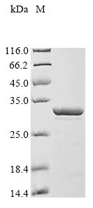 Recombinant Human Thymosin beta-10 (TMSB10) - image 1