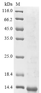 (Tris-Glycine gel) Discontinuous SDS-PAGE (reduced) with 5% enrichment gel and 15% separation gel. (Tris-Glycine gel) Discontinuous SDS-PAGE (reduced) with 5% enrichment gel and 15% separation gel.