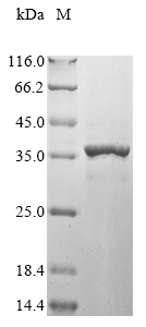 Recombinant Astacus leptodactylus Troponin I - image 1