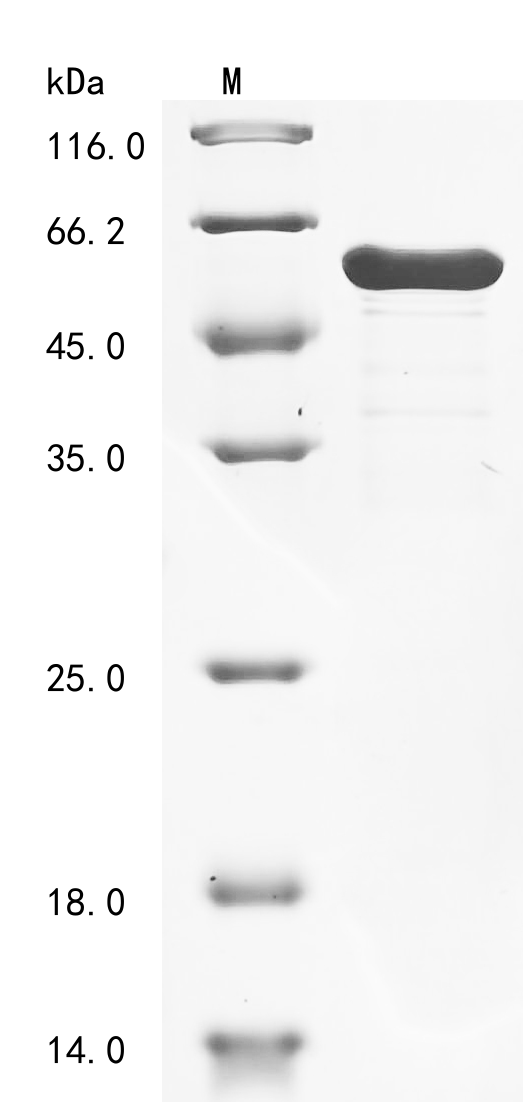 Recombinant Mouse Troponin T, cardiac muscle (Tnnt2) - image 1