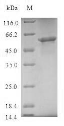 (Tris-Glycine gel) Discontinuous SDS-PAGE (reduced) with 5% enrichment gel and 15% separation gel. (Tris-Glycine gel) Discontinuous SDS-PAGE (reduced) with 5% enrichment gel and 15% separation gel.