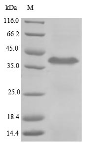 (Tris-Glycine gel) Discontinuous SDS-PAGE (reduced) with 5% enrichment gel and 15% separation gel. (Tris-Glycine gel) Discontinuous SDS-PAGE (reduced) with 5% enrichment gel and 15% separation gel.