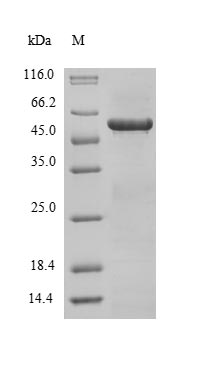 (Tris-Glycine gel) Discontinuous SDS-PAGE (reduced) with 5% enrichment gel and 15% separation gel. (Tris-Glycine gel) Discontinuous SDS-PAGE (reduced) with 5% enrichment gel and 15% separation gel.
