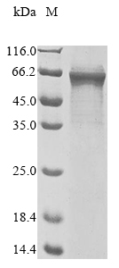 (Tris-Glycine gel) Discontinuous SDS-PAGE (reduced) with 5% enrichment gel and 15% separation gel. (Tris-Glycine gel) Discontinuous SDS-PAGE (reduced) with 5% enrichment gel and 15% separation gel.