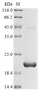 (Tris-Glycine gel) Discontinuous SDS-PAGE (reduced) with 5% enrichment gel and 15% separation gel. (Tris-Glycine gel) Discontinuous SDS-PAGE (reduced) with 5% enrichment gel and 15% separation gel.