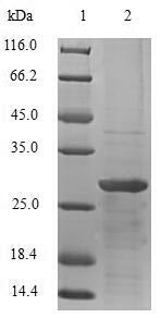 (Tris-Glycine gel) Discontinuous SDS-PAGE (reduced) with 5% enrichment gel and 15% separation gel. (Tris-Glycine gel) Discontinuous SDS-PAGE (reduced) with 5% enrichment gel and 15% separation gel.