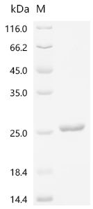 Recombinant Mouse Thyrotropin subunit beta (Tshb) , partial - image 1