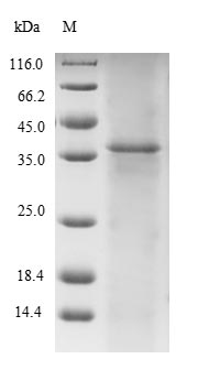 SDS-PAGE- Recombinant protein Human TTN