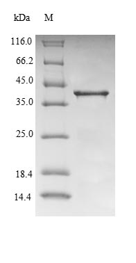 (Tris-Glycine gel) Discontinuous SDS-PAGE (reduced) with 5% enrichment gel and 15% separation gel. (Tris-Glycine gel) Discontinuous SDS-PAGE (reduced) with 5% enrichment gel and 15% separation gel.