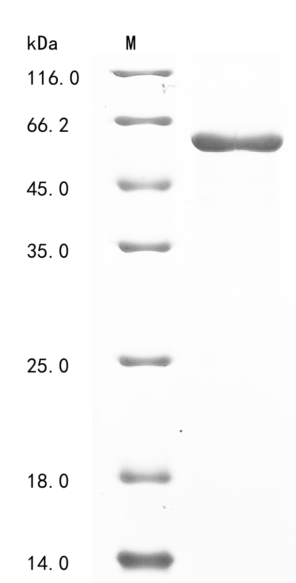 (Tris-Glycine gel) Discontinuous SDS-PAGE (reduced) with 5% enrichment gel and 15% separation gel. (Tris-Glycine gel) Discontinuous SDS-PAGE (reduced) with 5% enrichment gel and 15% separation gel.