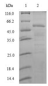 (Tris-Glycine gel) Discontinuous SDS-PAGE (reduced) with 5% enrichment gel and 15% separation gel. (Tris-Glycine gel) Discontinuous SDS-PAGE (reduced) with 5% enrichment gel and 15% separation gel.