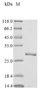 Recombinant Human Voltage-dependent anion-selective channel protein 1 (VDAC1) , partial - image 1