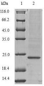 (Tris-Glycine gel) Discontinuous SDS-PAGE (reduced) with 5% enrichment gel and 15% separation gel. (Tris-Glycine gel) Discontinuous SDS-PAGE (reduced) with 5% enrichment gel and 15% separation gel.