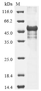 (Tris-Glycine gel) Discontinuous SDS-PAGE (reduced) with 5% enrichment gel and 15% separation gel. (Tris-Glycine gel) Discontinuous SDS-PAGE (reduced) with 5% enrichment gel and 15% separation gel.