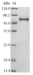 (Tris-Glycine gel) Discontinuous SDS-PAGE (reduced) with 5% enrichment gel and 15% separation gel. (Tris-Glycine gel) Discontinuous SDS-PAGE (reduced) with 5% enrichment gel and 15% separation gel.