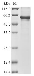 (Tris-Glycine gel) Discontinuous SDS-PAGE (reduced) with 5% enrichment gel and 15% separation gel. (Tris-Glycine gel) Discontinuous SDS-PAGE (reduced) with 5% enrichment gel and 15% separation gel.